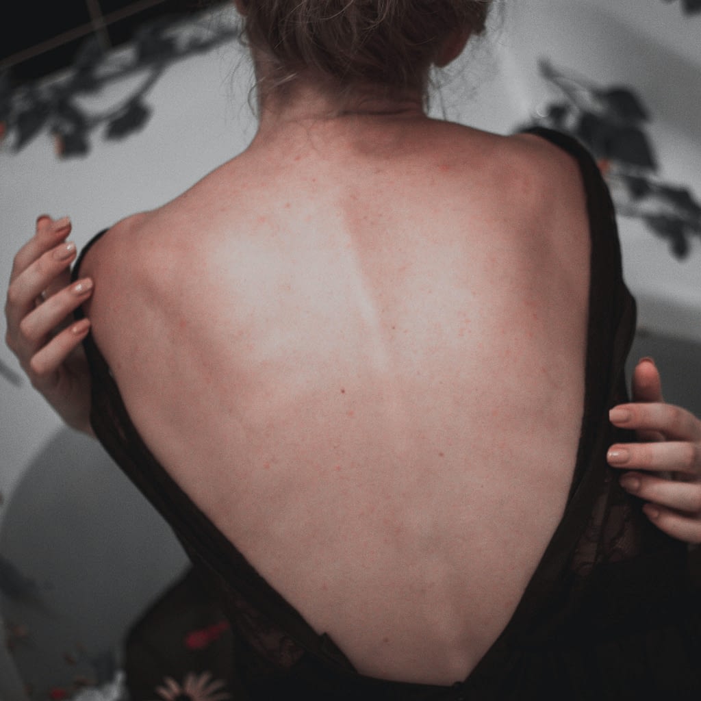Woman sitting with backless dress, spine visible